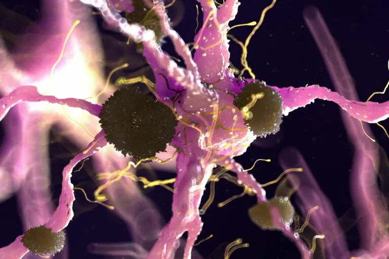 Protéine amyloïde accumulée en cas d'Alzheimer